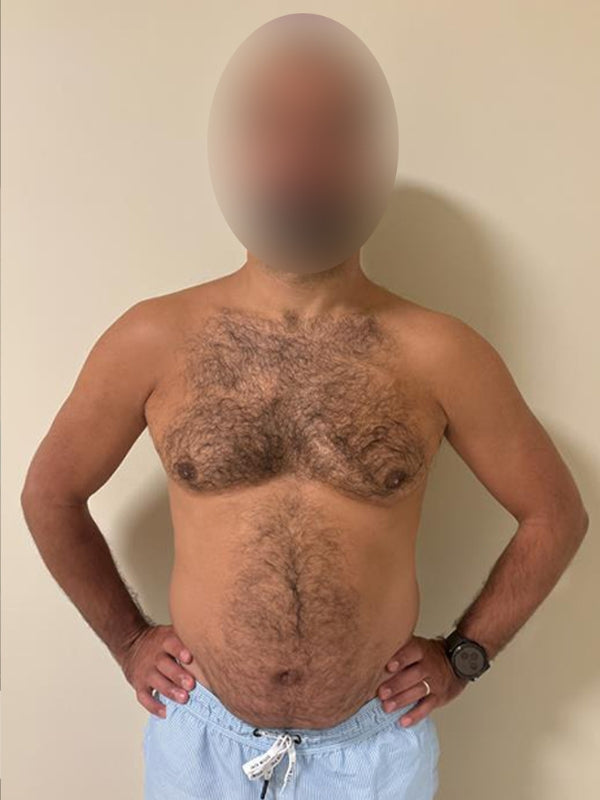 Darweesh before transformation